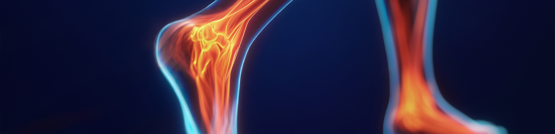 Prinses Beatrix Spierfonds